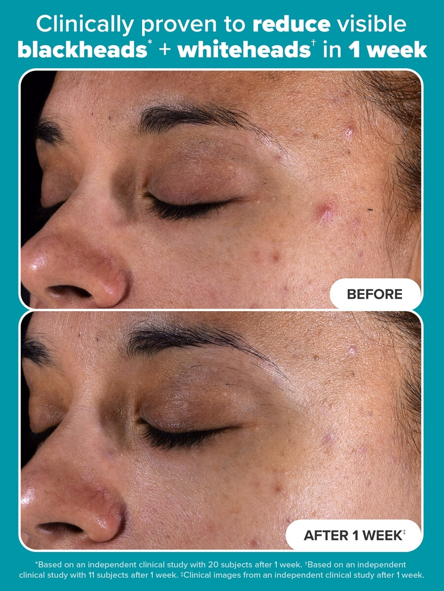 skin perfecting 2 bha płynny peeling