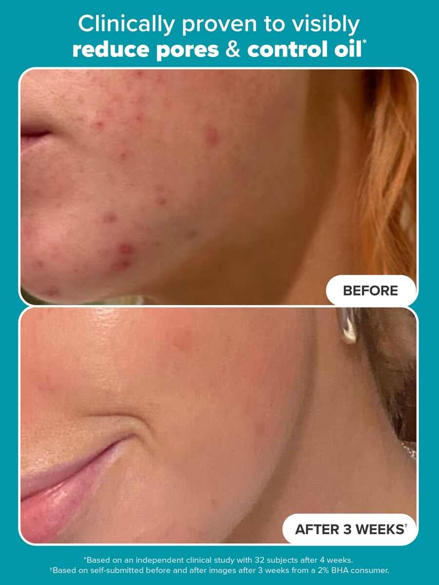 skin perfecting 2 bha płynny peeling