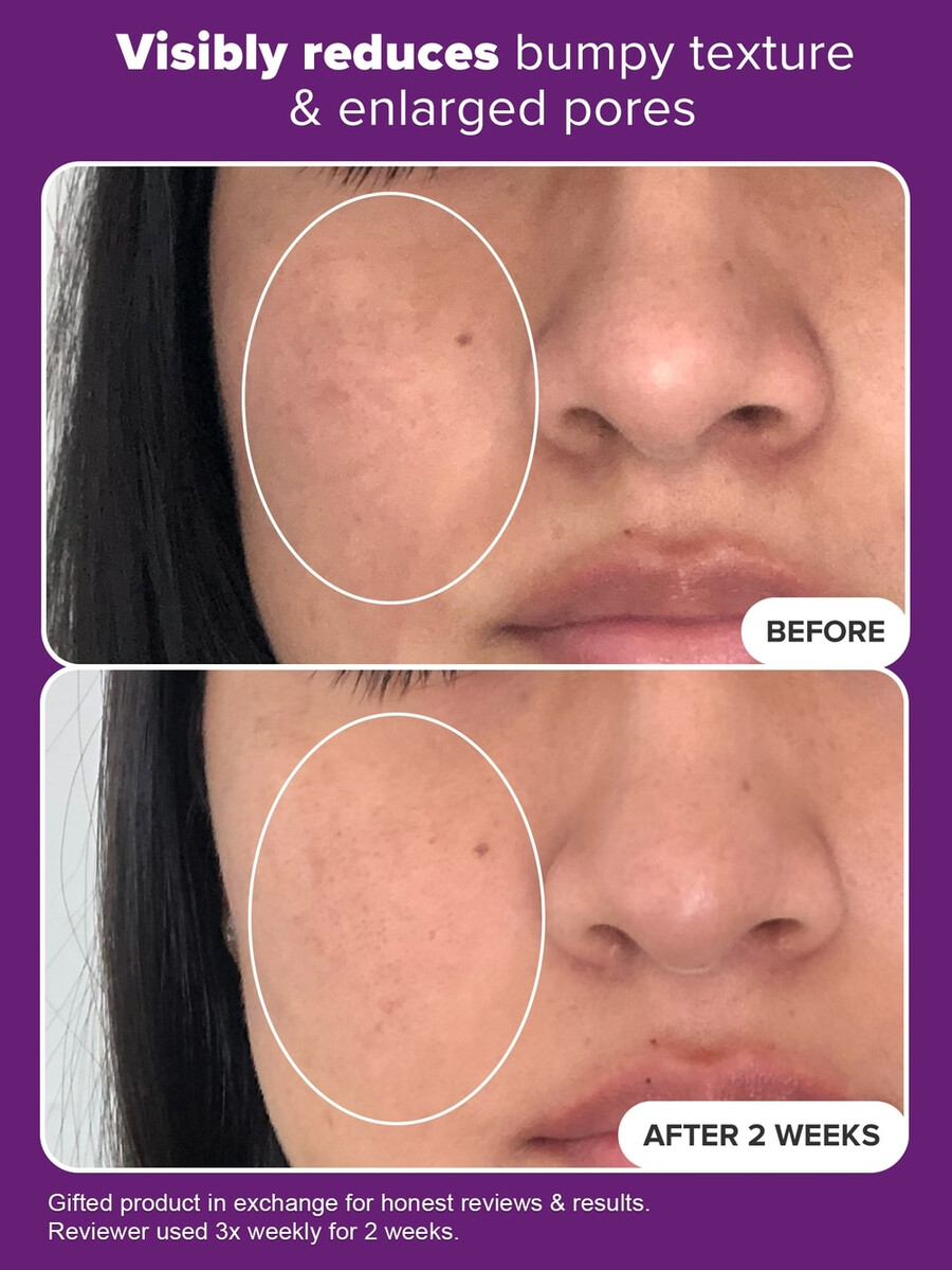 kliniczna kuracja serum z 20 niacynamidem