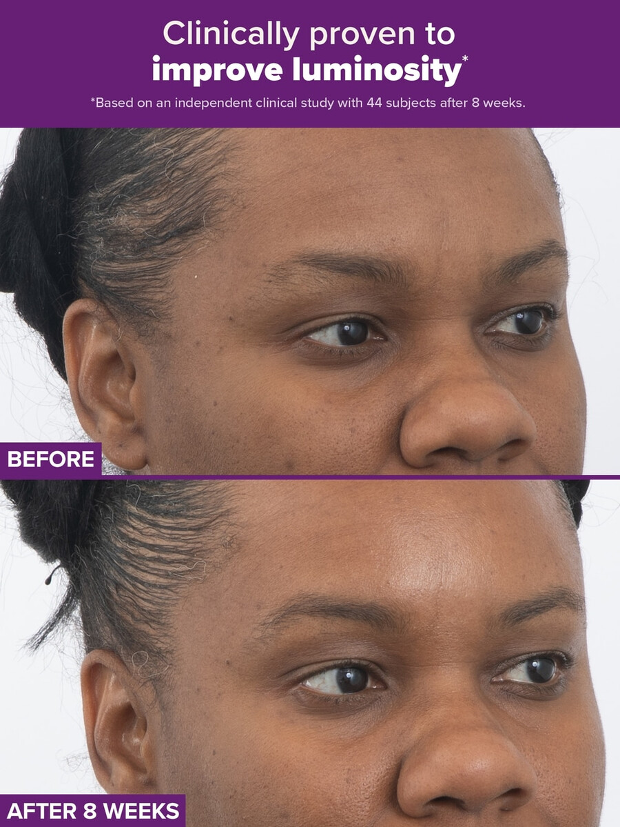 clinical pro podwójna terapia retinoidowa z retinaldehydem